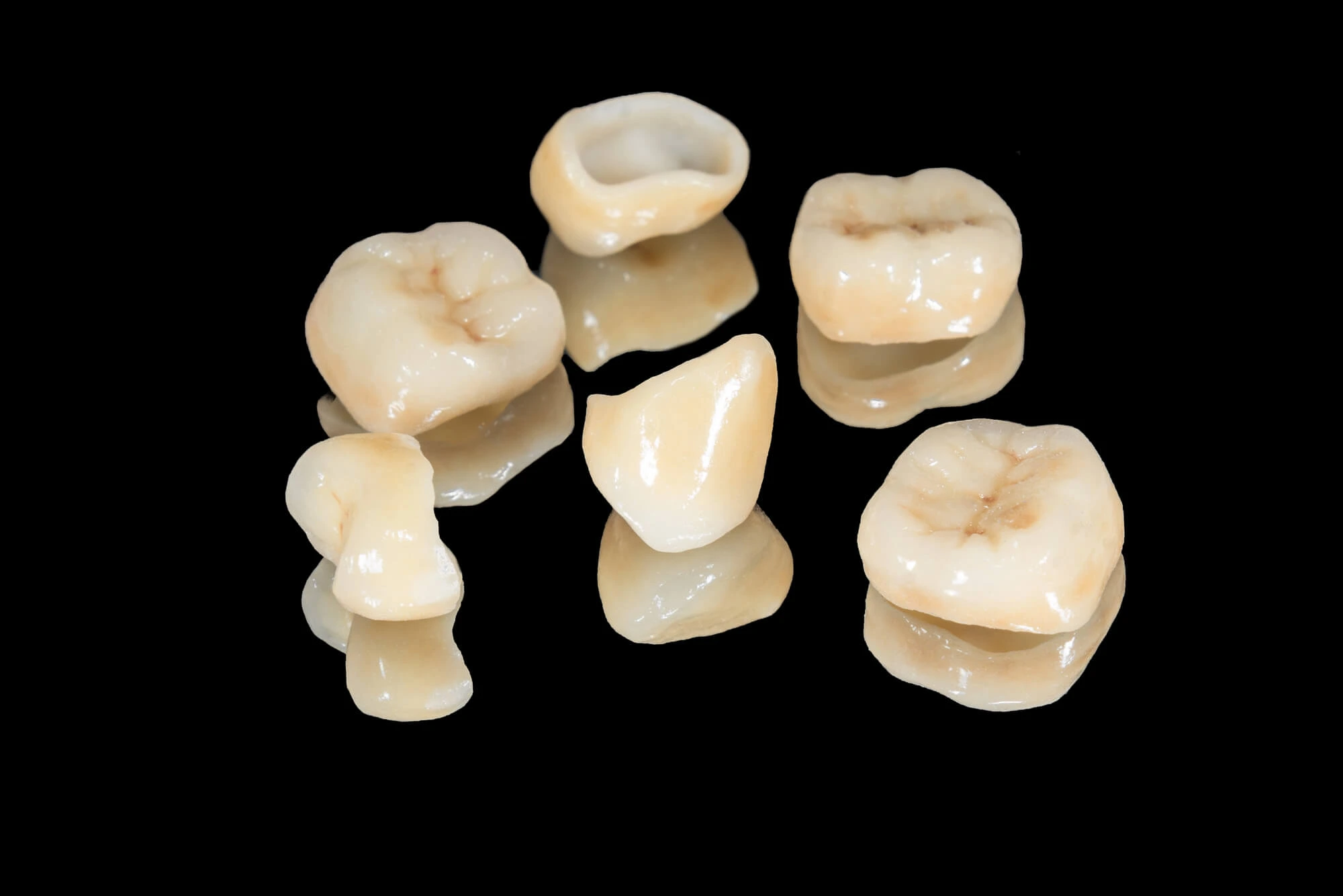 Mantain Your Same Day Crowns in 29678