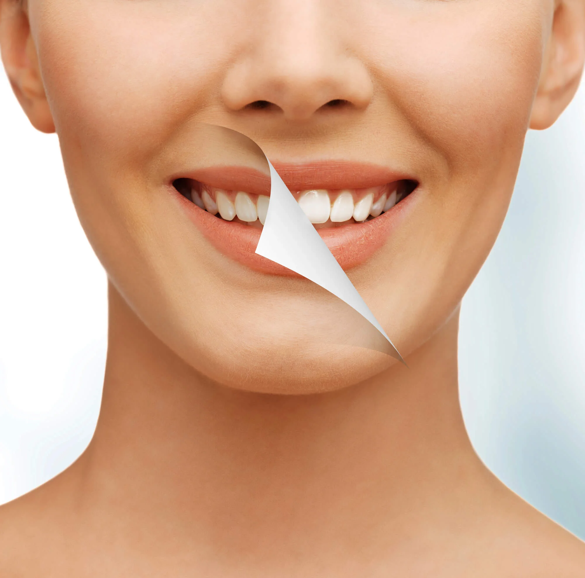 bright smile comparison fluoride treatments in Seneca