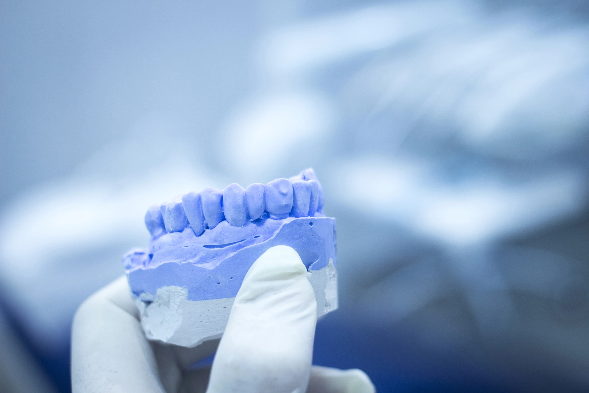 dental model for same day crowns in 29678